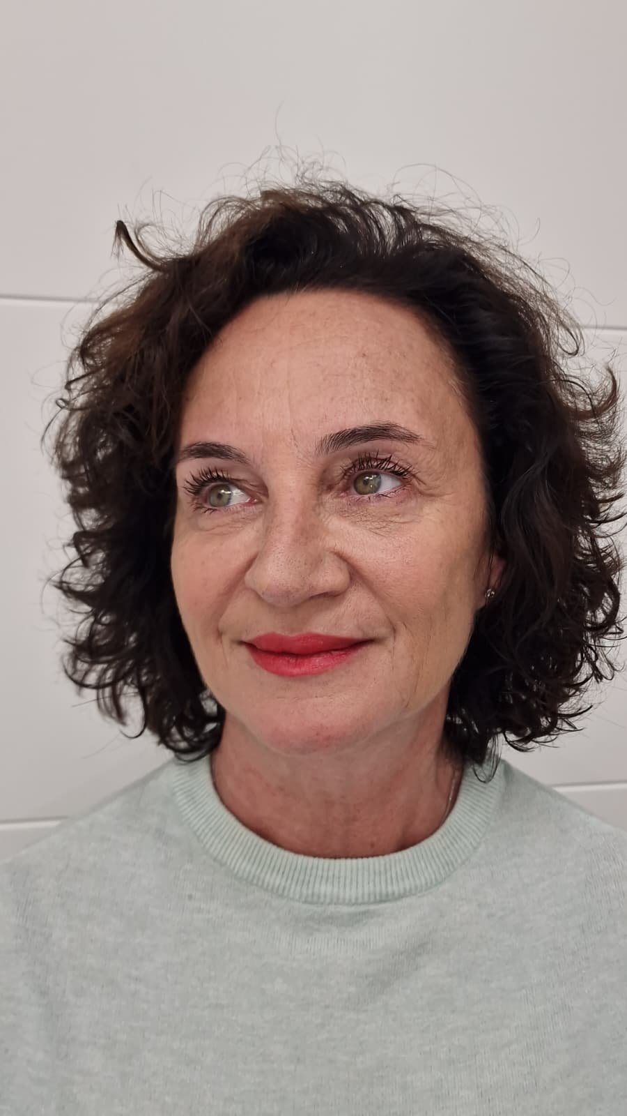 Después de la armonización facial