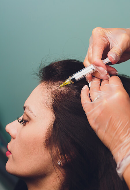 hair-transplant