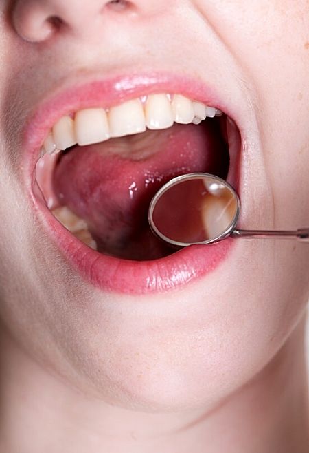 Oferta Implante Dental Verano 2021-Clinic Mallorca MED